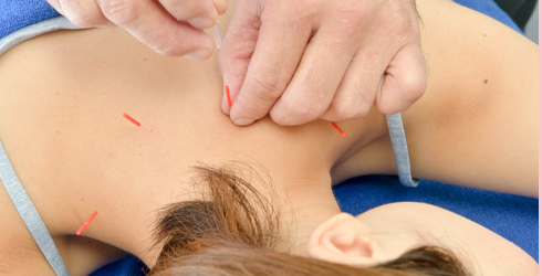 Beauty Acupuncture